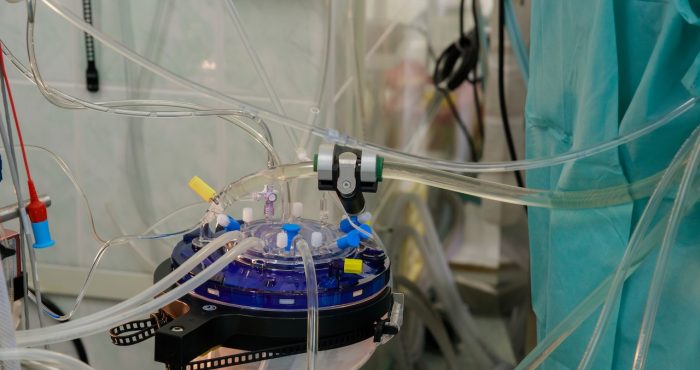 Apparatus circulation blood in operating room heart lung machine for heart surgery